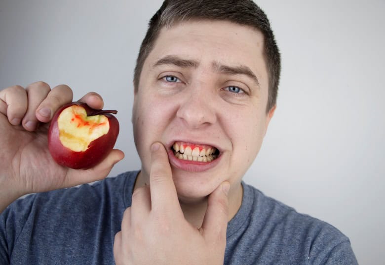 man with bleeding gums holding an apple